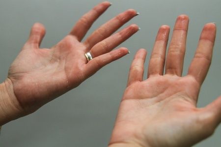 Por qué nos sudan las manos cuando estamos nerviosos? | Confirmado -