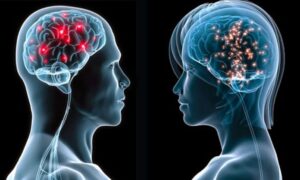IA identifica que los cerebros de hombres y mujeres se organizan de forma diferente