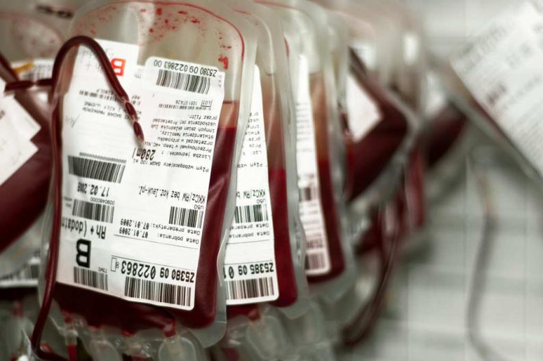 La primera transfusión de sangre
